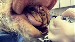 Veterinary working on horse mouth