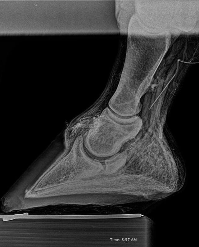 Foot X-Ray Site View